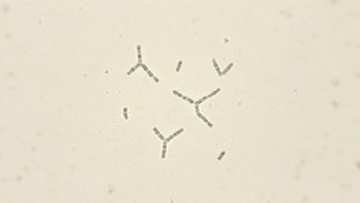 Branched, forked rod-shaped bacteria seen under a light microscope