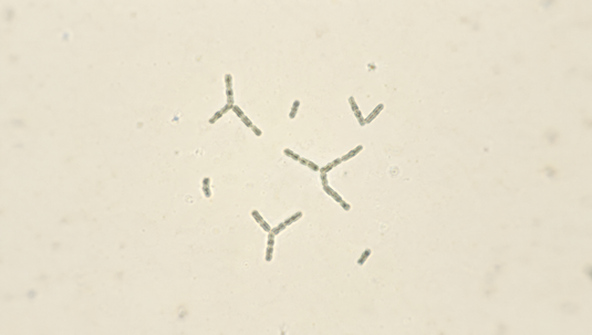 Branched, forked rod-shaped bacteria seen under a light microscope